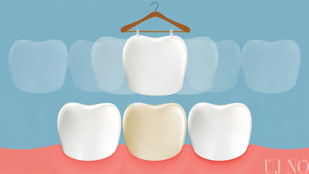 augusztusi-lapajanlo-veneer.jpg