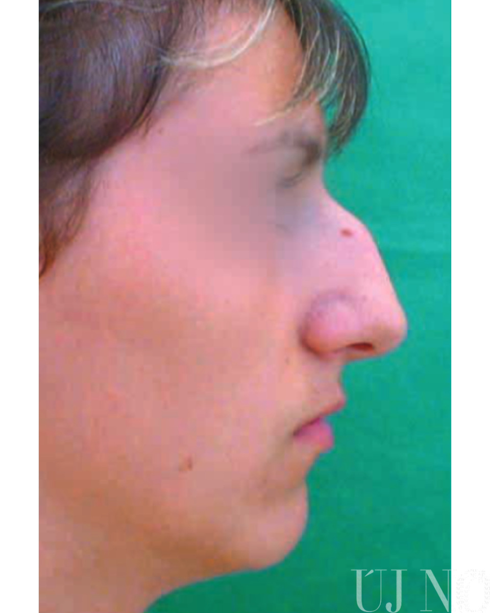 uj_no_4_5_allo_6.jpg