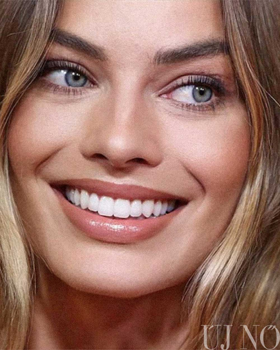 veneer-margot-robbie.jpg
