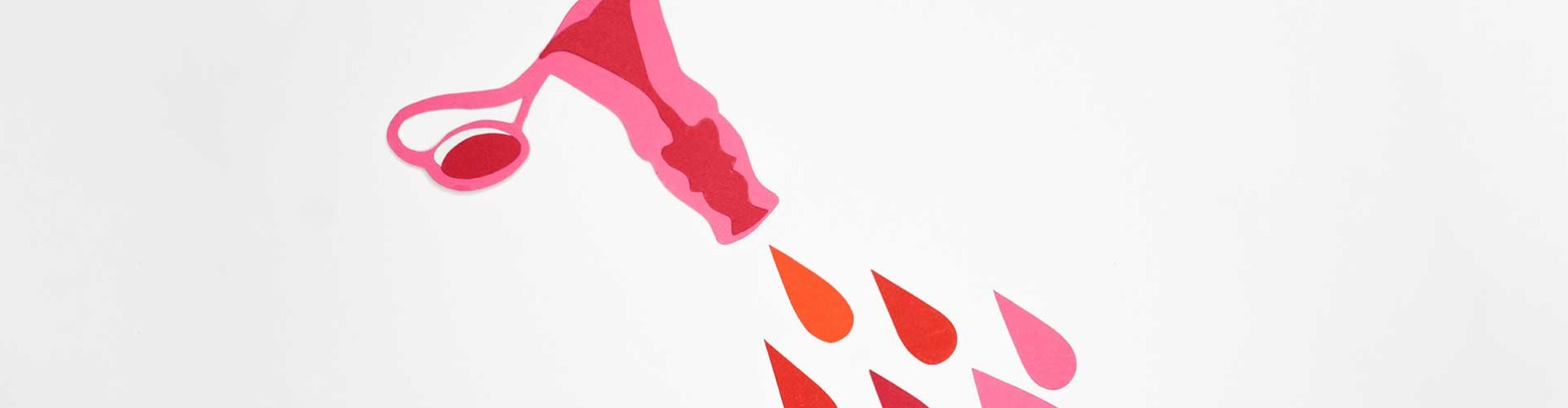 Amit a menstruációs zavarokról tudni érdemes Amit a menstruációs zavarokról tudni érdemes
