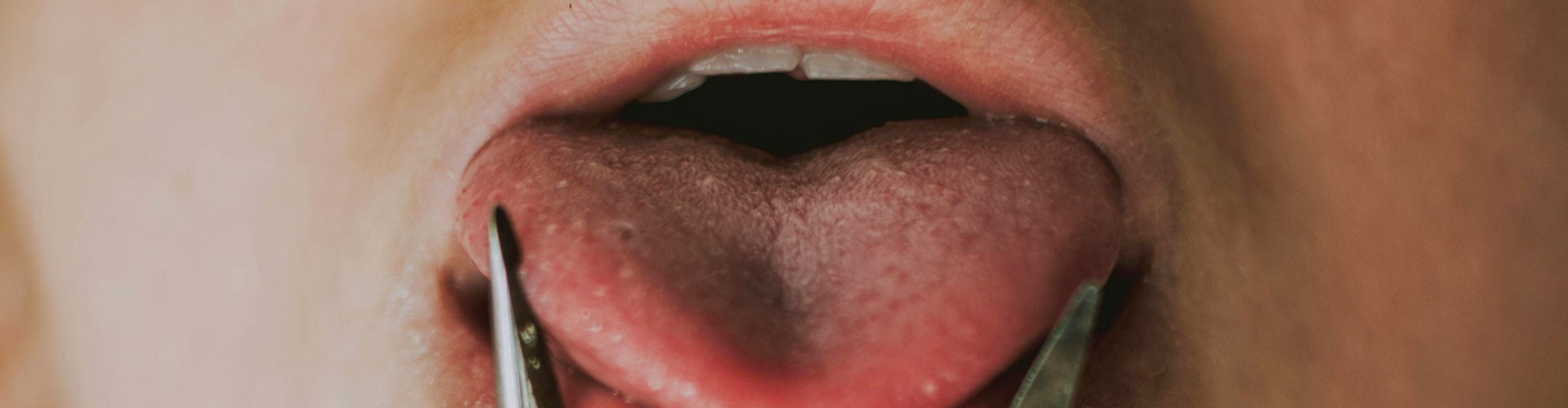 A lekötözött nyelv A lekötözött nyelv