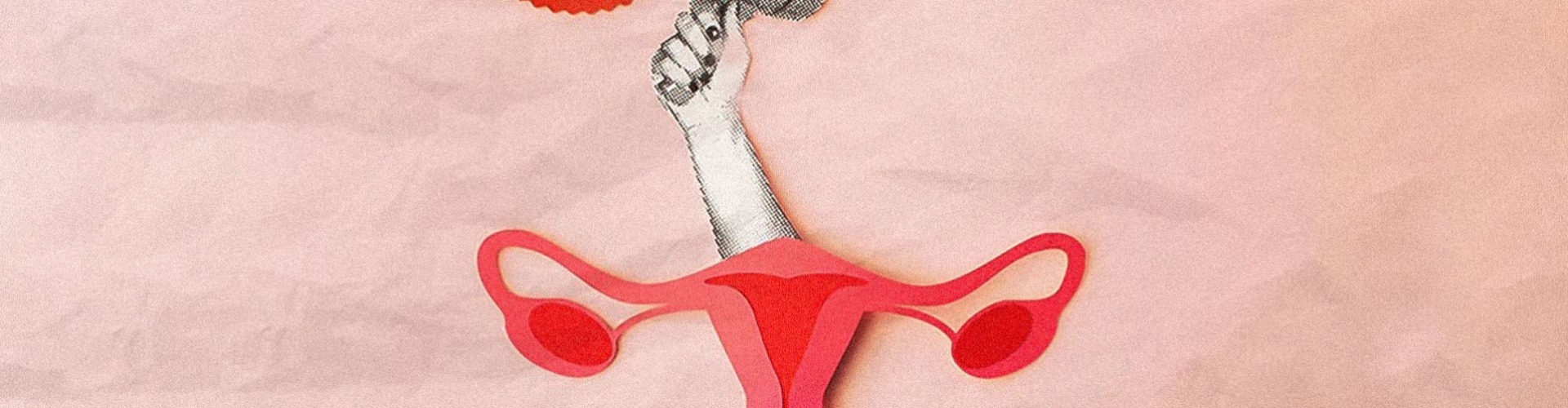 Még mindig ismeretlen az endometriózis!