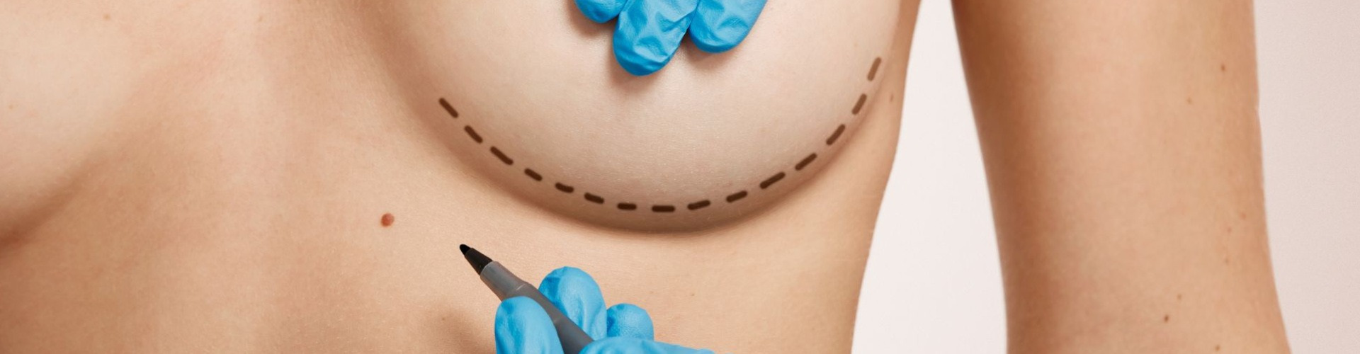 A nagy átalakítás