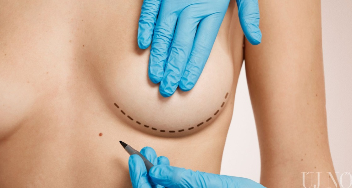 A nagy átalakítás